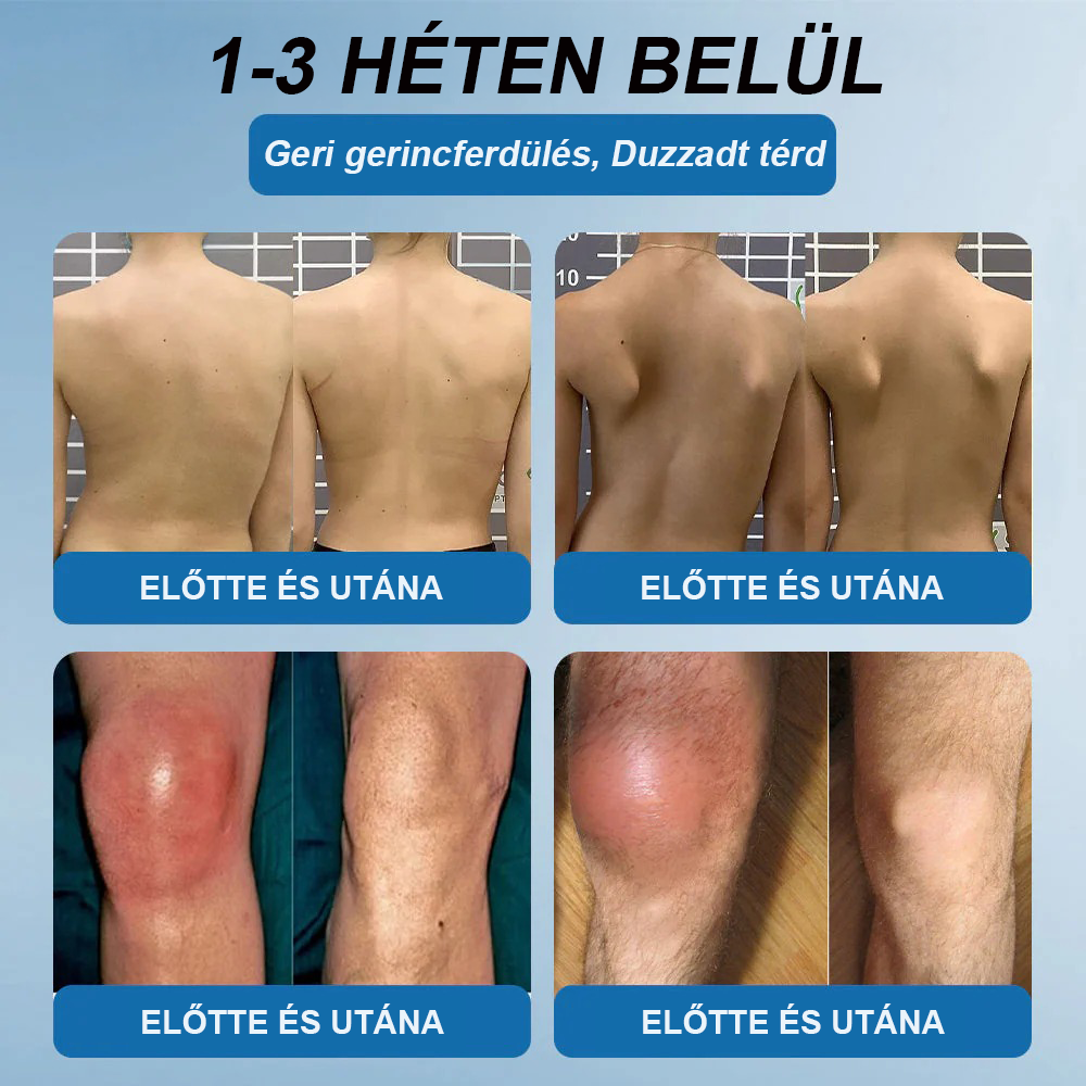 𝖯𝗂𝖼𝗱𝗼® BPC-157 Ízületi Gyógyító Krém🦴Ízületi gyulladás, neuropátia, reuma, sportsérülések és egyebek kezelésére🦵