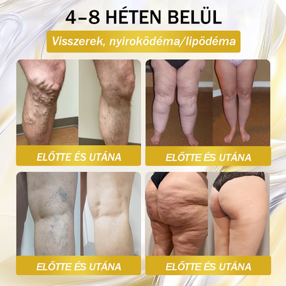 🇭🇺 Országos Gyógyszerészeti és Élelmiszer-higiéniai Intézet (OGYÉI) | Hivatalos magyar márka — Croaie® Tirapapeptid Orális Oldat GIP + GLP-1 Kettős Hatású Fejlett Fogyókúrás Formula – Naponta egyszer, akár 7 nap alatt is eredményt ad 🏅