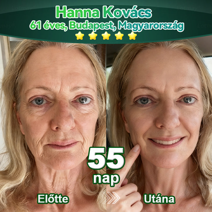 𝑳𝒐𝒕𝑚𝑎𝑦® Ő𝑠𝑠𝑒𝑗𝑡 & 𝐾𝑜𝑙𝑙𝑎𝑔é𝑛 𝑷𝒆𝒑𝒕𝒊𝒅 𝑶𝒓á𝒍𝒊𝒔 𝑪𝒔𝒆𝒑𝒑𝒆𝒌 💧(𝑭𝒆𝒔𝒛𝒆𝒔í𝒕𝒊 𝒂 𝒎𝒆𝒈𝒆𝒓𝒆𝒔𝒛𝒌𝒆𝒅𝒆𝒕𝒕 𝒃ő𝒓𝒕 & 𝑪𝒔ö𝒌𝒌𝒆𝒏𝒕𝒊 𝒂 𝒓á𝒏𝒄𝒌é𝒑𝒛ő𝒅é𝒔𝒕)❤️‍🔥🔥