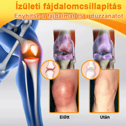 ✅ Hivatalos áruház: Ouryard™ Magnéziumolaj és Mézes Ízületjavító Spray 👨‍⚕️ Jóváhagyva a Magyar Gyógyszerészeti és Egészségügyi Minőség- és Szervezetfejlesztési Intézet (OGYÉI) által. 🔥🔥🔥🔥