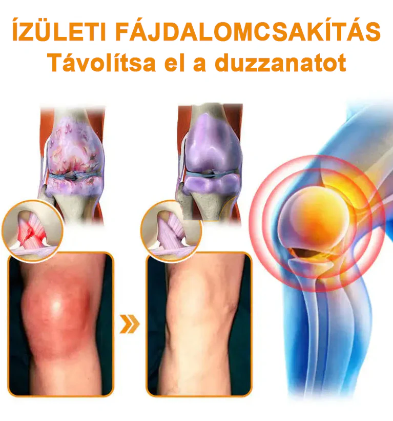 ✅ Hivatalos áruház: Ouryard™ Magnéziumolaj és Mézes Ízületjavító Spray 👨‍⚕️ Jóváhagyva a Magyar Gyógyszerészeti és Egészségügyi Minőség- és Szervezetfejlesztési Intézet (OGYÉI) által. 🔥🔥🔥🔥