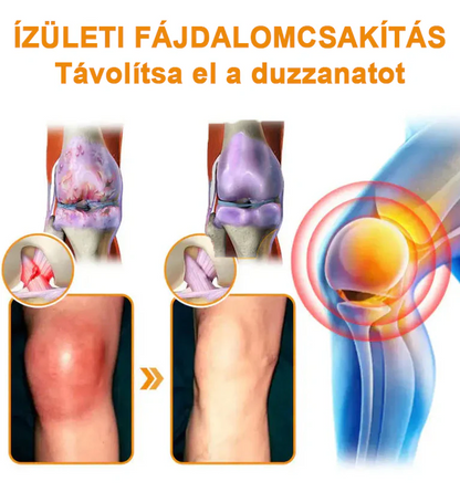 ✅ Hivatalos áruház: Ouryard™ Magnéziumolaj és Mézes Ízületjavító Spray 👨‍⚕️ Jóváhagyva a Magyar Gyógyszerészeti és Egészségügyi Minőség- és Szervezetfejlesztési Intézet (OGYÉI) által. 🔥🔥🔥🔥