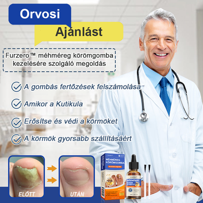 👣🐝🐝Furzero™ Méhméreg Körömgomba Kezelőoldat: Teljes megoldás a körömgomba problémájára🌟👣🐝👣
