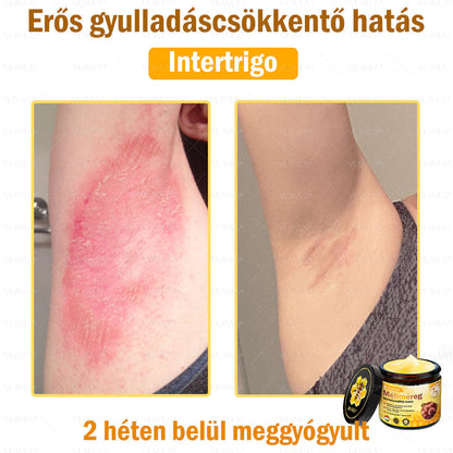 VLSVLS® Méhméreg Bőrhelyreállító Krém (👨‍⚕‍CE jóváhagyott)👍✅✅