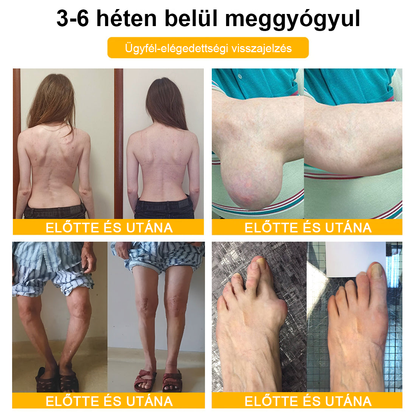 🦴TLOPA® Botulinum Toxin és Méhméreg Fájdalomcsillapító Csontgyógyító Krém🐝 🔥(Kifejezetten időseknek & ortopéd szakorvosok ajánlásával)🦴