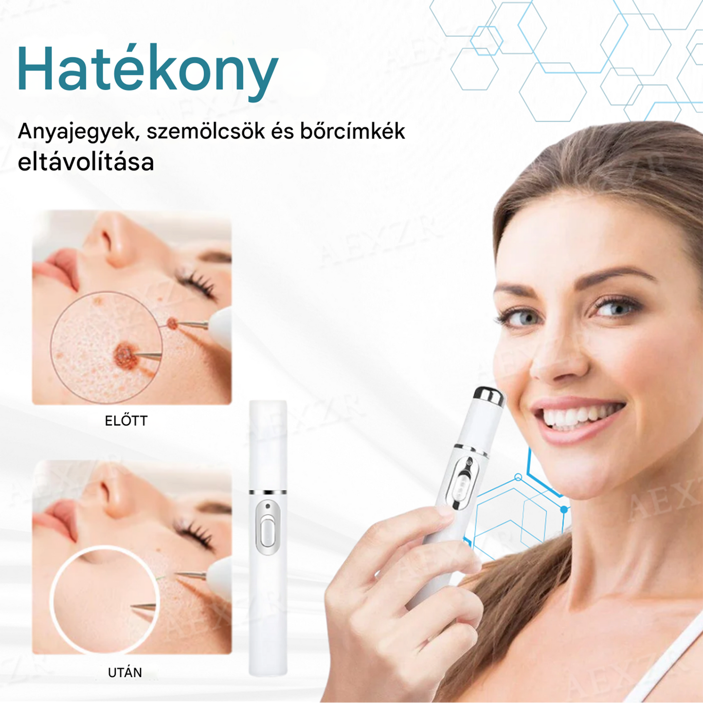 🔥Bikenda® non-invazív anyajegy- és szemölcseltávolító lézertoll🔥🔥🔥