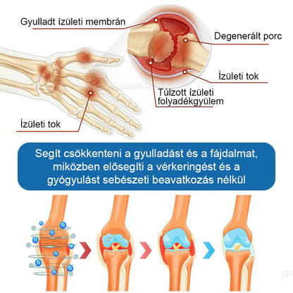 𝖯𝗂𝖼𝗱𝗼® BPC-157 Ízületi Gyógyító Krém🦴Ízületi gyulladás, neuropátia, reuma, sportsérülések és egyebek kezelésére🦵🦵🦵