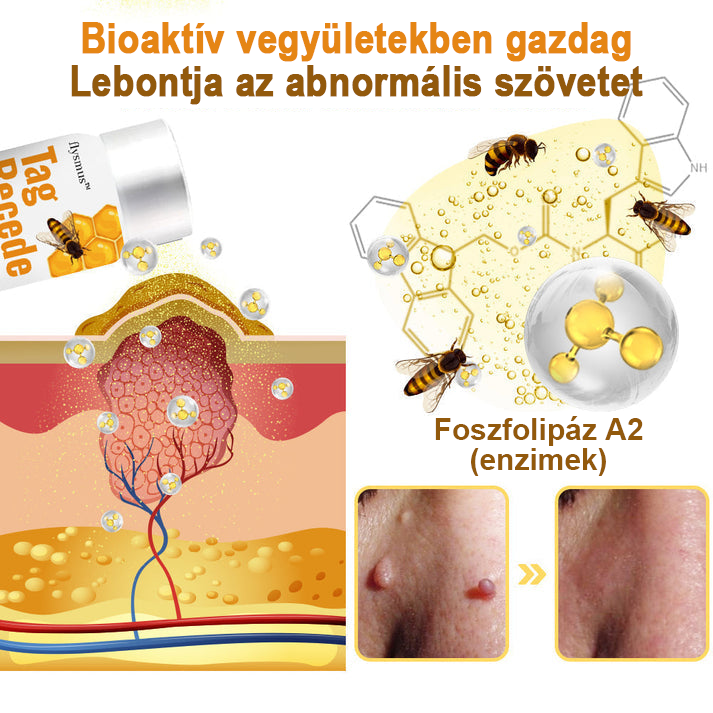 [💗utánvétel (COD)💗] Flysmus™Méhméreg szemölcs és övsömör eltávolító spray (👨‍⚕AAD Ajánlott) 🐝🐝(🔥Last Day 80% Off)🔥🔥