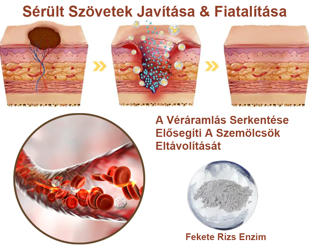 ✅ Zvoevo® Fekete Rizses Bőrregeneráló Krém 👨‍⚕️ (Szemölcsök, bőrkinövések, foltok és hiperpigmentáció kezelésére)✅