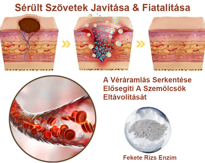 ✅ Zvoevo® Fekete Rizses Bőrregeneráló Krém 👨‍⚕️ (Szemölcsök, bőrkinövések, foltok és hiperpigmentáció kezelésére)✅