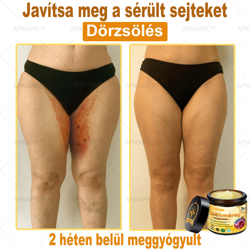 𝐀𝐏𝐊𝐀𝐏𝐊™ 𝐌É𝐇𝐌É𝐑𝐄𝐆 Á𝐓𝐅𝐎𝐆Ó 𝐊𝐑É𝐌🥇🥇𝐀 𝐛ö𝐫𝐩𝐫𝐨𝐛𝐥é𝐦á𝐤 𝐤𝐞𝐳𝐞𝐥é𝐬𝐞 𝐦𝐚𝐠á𝐛𝐚𝐧 𝐟𝐨𝐠𝐥𝐚𝐥𝐣𝐚: é𝐥𝐞𝐭𝐤𝐨𝐫𝐢 𝐟𝐨𝐥𝐭𝐨𝐤, 𝐡𝐞𝐠𝐞𝐤, 𝐬𝐳𝐞𝐦ö𝐥𝐜𝐬ö𝐤, 𝐛ö𝐫𝐧ö𝐯𝐞𝐝é𝐤𝐞𝐤, 𝐭á𝐥𝐲𝐨𝐠𝐨𝐤, 𝐩𝐚𝐭𝐭𝐚𝐧á𝐬𝐨𝐤, 𝐞𝐤𝐜é𝐦𝐚, 𝐩𝐬𝐨𝐫𝐢𝐚𝐬𝐢𝐬, 𝐚𝐜𝐧𝐞 𝐢𝐧𝐯𝐞𝐫𝐬𝐚, 𝐫á𝐧𝐜𝐨𝐤, 𝐛ö𝐫ö𝐫𝐞𝐠𝐞𝐝é𝐬 é𝐬 𝐞𝐠𝐲é𝐛 𝐩𝐫𝐨𝐛𝐥é𝐦á𝐤🔥🔥