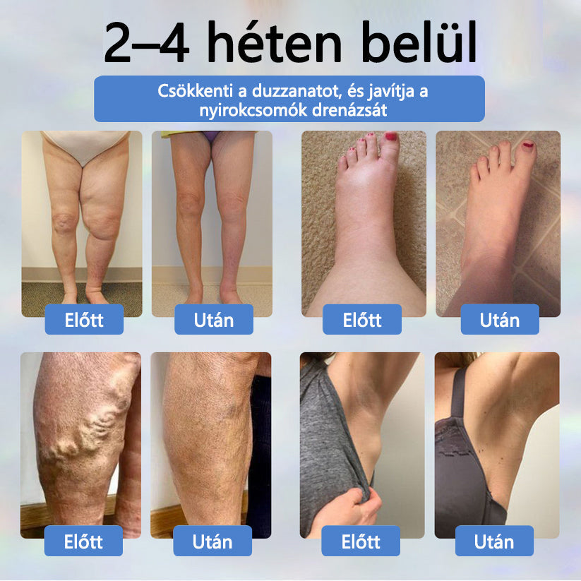 💧ATTDX® Növényi ödéma enyhítő krém nigellával💧💧💧💧