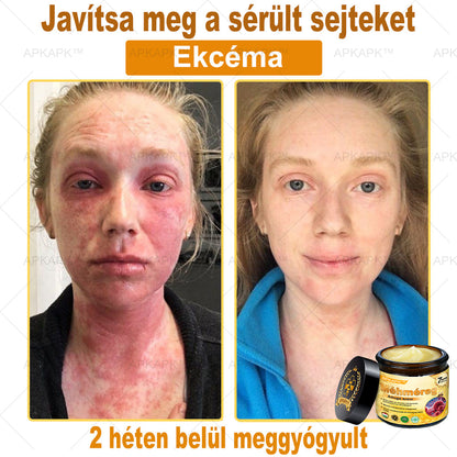 𝐀𝐏𝐊𝐀𝐏𝐊™ 𝐌É𝐇𝐌É𝐑𝐄𝐆 Á𝐓𝐅𝐎𝐆Ó 𝐊𝐑É𝐌🥇🥇𝐀 𝐛ö𝐫𝐩𝐫𝐨𝐛𝐥é𝐦á𝐤 𝐤𝐞𝐳𝐞𝐥é𝐬𝐞 𝐦𝐚𝐠á𝐛𝐚𝐧 𝐟𝐨𝐠𝐥𝐚𝐥𝐣𝐚: é𝐥𝐞𝐭𝐤𝐨𝐫𝐢 𝐟𝐨𝐥𝐭𝐨𝐤, 𝐡𝐞𝐠𝐞𝐤, 𝐬𝐳𝐞𝐦ö𝐥𝐜𝐬ö𝐤, 𝐛ö𝐫𝐧ö𝐯𝐞𝐝é𝐤𝐞𝐤, 𝐭á𝐥𝐲𝐨𝐠𝐨𝐤, 𝐩𝐚𝐭𝐭𝐚𝐧á𝐬𝐨𝐤, 𝐞𝐤𝐜é𝐦𝐚, 𝐩𝐬𝐨𝐫𝐢𝐚𝐬𝐢𝐬, 𝐚𝐜𝐧𝐞 𝐢𝐧𝐯𝐞𝐫𝐬𝐚, 𝐫á𝐧𝐜𝐨𝐤, 𝐛ö𝐫ö𝐫𝐞𝐠𝐞𝐝é𝐬 é𝐬 𝐞𝐠𝐲é𝐛 𝐩𝐫𝐨𝐛𝐥é𝐦á𝐤🔥🔥