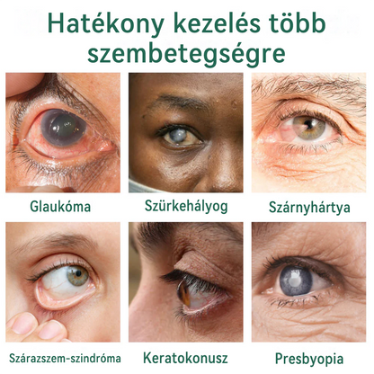 👩‍⚕️ Ourlyard® Nano Szemcsepp Szérum ✅ OGYÉI engedéllyel (alkalmas presbiópia, száraz szem szindróma, zöldhályog és szürkehályog kezelésére) ☘️☘️