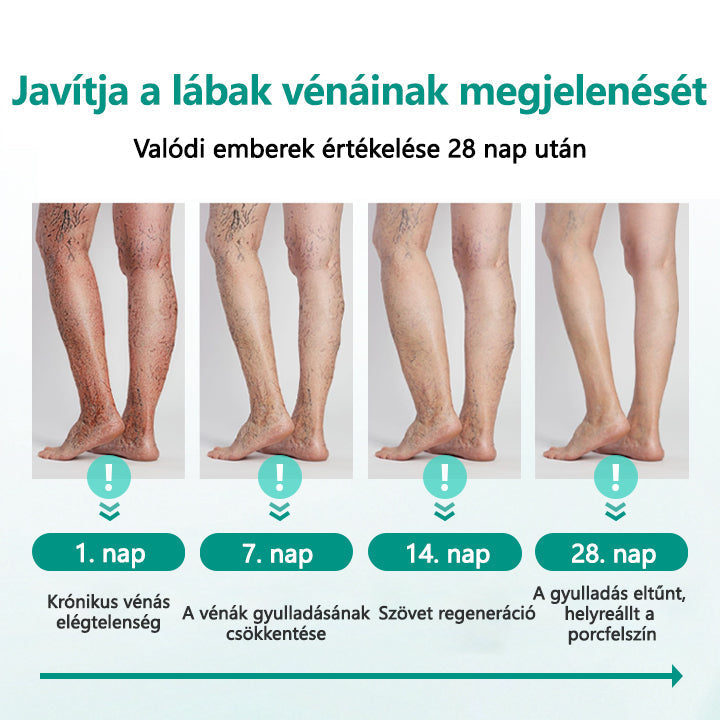 Cvreoz® LegRenew visszér tapasz javítja a vénák egészségét és megszünteti a visszereket🌿Nincs tű, nincs műtét, csak biztonságos, gyengéd és hatékony eredmény✨✨