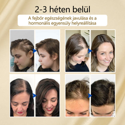 Timilk® VitaStrand Biotin hajnövekedést elősegítő spray✅ Sűrű, fényes haj néhány hét alatt🔥