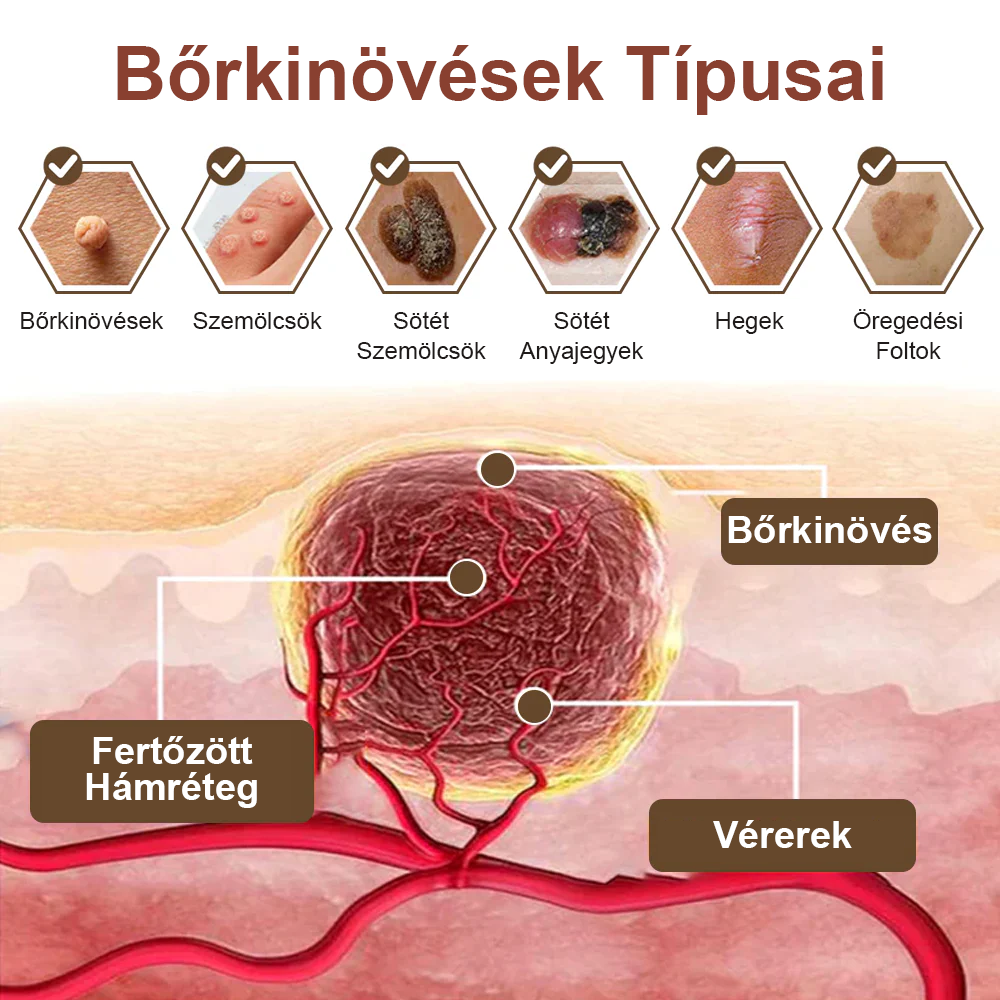 ✅ Zvoevo® Fekete Rizses Bőrregeneráló Krém 👨‍⚕️ (Szemölcsök, bőrkinövések, foltok és hiperpigmentáció kezelésére)✅
