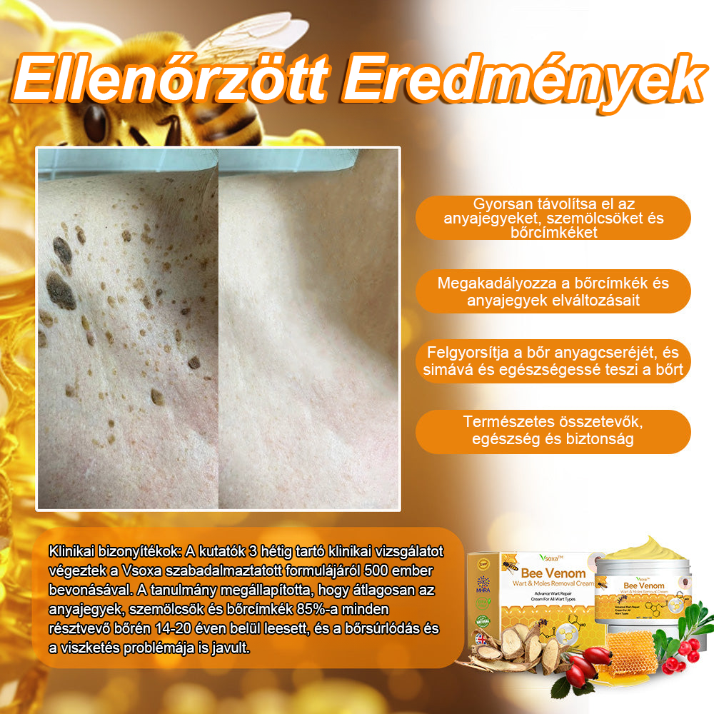 🏵️Vsoxa™ méhméreg szemölcs és anyajegy eltávolító krém (Utolsó napi akció, 80% kedvezmény)🌷