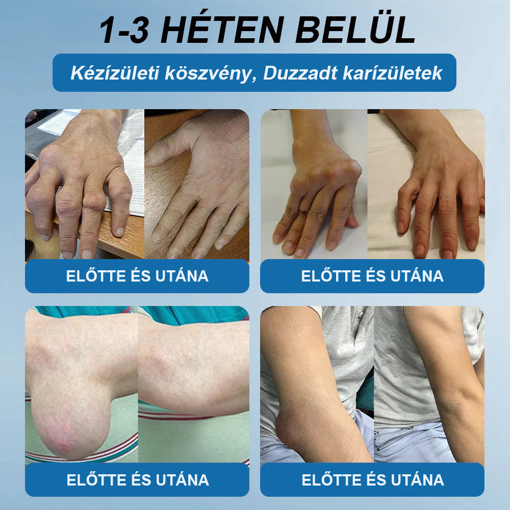 𝖯𝗂𝖼𝗱𝗼® BPC-157 Ízületi Gyógyító Krém🦴Ízületi gyulladás, neuropátia, reuma, sportsérülések és egyebek kezelésére🦵🦵🦵
