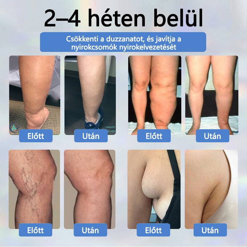 💧ATTDX® Növényi ödéma enyhítő krém nigellával💧💧💧💧