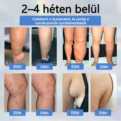 💧ATTDX® Növényi ödéma enyhítő krém nigellával💧💧💧💧