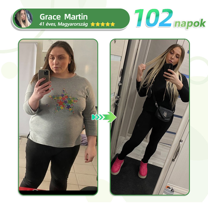 ✨[7 napon belül eredményt lát]🌻𝗧𝗟𝗢𝗣𝗔® 𝗚𝗟𝗣-𝟭 Nano Microneedle Patch🎀（Fájdalommentes, hosszan tartó, cukorbetegség, elhízás és szív- és érrendszeri betegségek kezelésére）🎀