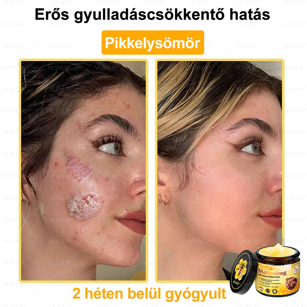VLSVLS® Méhméreg Bőrhelyreállító Krém (👨‍⚕‍CE jóváhagyott)👍✅✅