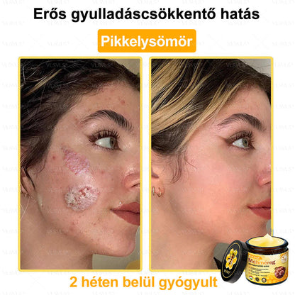 VLSVLS® Méhméreg Bőrhelyreállító Krém (👨‍⚕‍CE jóváhagyott)👍✅✅