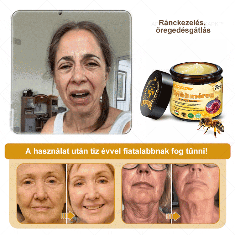 𝐀𝐏𝐊𝐀𝐏𝐊™ 𝐌É𝐇𝐌É𝐑𝐄𝐆 Á𝐓𝐅𝐎𝐆Ó 𝐊𝐑É𝐌🥇🥇𝐀 𝐛ö𝐫𝐩𝐫𝐨𝐛𝐥é𝐦á𝐤 𝐤𝐞𝐳𝐞𝐥é𝐬𝐞 𝐦𝐚𝐠á𝐛𝐚𝐧 𝐟𝐨𝐠𝐥𝐚𝐥𝐣𝐚: é𝐥𝐞𝐭𝐤𝐨𝐫𝐢 𝐟𝐨𝐥𝐭𝐨𝐤, 𝐡𝐞𝐠𝐞𝐤, 𝐬𝐳𝐞𝐦ö𝐥𝐜𝐬ö𝐤, 𝐛ö𝐫𝐧ö𝐯𝐞𝐝é𝐤𝐞𝐤, 𝐭á𝐥𝐲𝐨𝐠𝐨𝐤, 𝐩𝐚𝐭𝐭𝐚𝐧á𝐬𝐨𝐤, 𝐞𝐤𝐜é𝐦𝐚, 𝐩𝐬𝐨𝐫𝐢𝐚𝐬𝐢𝐬, 𝐚𝐜𝐧𝐞 𝐢𝐧𝐯𝐞𝐫𝐬𝐚, 𝐫á𝐧𝐜𝐨𝐤, 𝐛ö𝐫ö𝐫𝐞𝐠𝐞𝐝é𝐬 é𝐬 𝐞𝐠𝐲é𝐛 𝐩𝐫𝐨𝐛𝐥é𝐦á𝐤🔥🔥