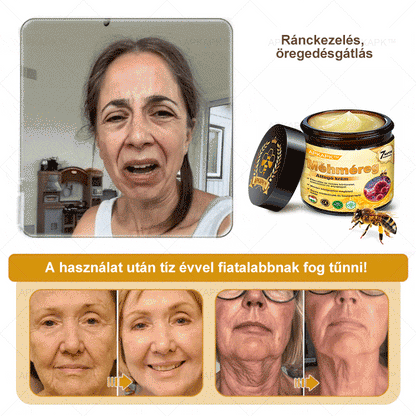 𝐀𝐏𝐊𝐀𝐏𝐊™ 𝐌É𝐇𝐌É𝐑𝐄𝐆 Á𝐓𝐅𝐎𝐆Ó 𝐊𝐑É𝐌🥇🥇𝐀 𝐛ö𝐫𝐩𝐫𝐨𝐛𝐥é𝐦á𝐤 𝐤𝐞𝐳𝐞𝐥é𝐬𝐞 𝐦𝐚𝐠á𝐛𝐚𝐧 𝐟𝐨𝐠𝐥𝐚𝐥𝐣𝐚: é𝐥𝐞𝐭𝐤𝐨𝐫𝐢 𝐟𝐨𝐥𝐭𝐨𝐤, 𝐡𝐞𝐠𝐞𝐤, 𝐬𝐳𝐞𝐦ö𝐥𝐜𝐬ö𝐤, 𝐛ö𝐫𝐧ö𝐯𝐞𝐝é𝐤𝐞𝐤, 𝐭á𝐥𝐲𝐨𝐠𝐨𝐤, 𝐩𝐚𝐭𝐭𝐚𝐧á𝐬𝐨𝐤, 𝐞𝐤𝐜é𝐦𝐚, 𝐩𝐬𝐨𝐫𝐢𝐚𝐬𝐢𝐬, 𝐚𝐜𝐧𝐞 𝐢𝐧𝐯𝐞𝐫𝐬𝐚, 𝐫á𝐧𝐜𝐨𝐤, 𝐛ö𝐫ö𝐫𝐞𝐠𝐞𝐝é𝐬 é𝐬 𝐞𝐠𝐲é𝐛 𝐩𝐫𝐨𝐛𝐥é𝐦á𝐤🔥🔥