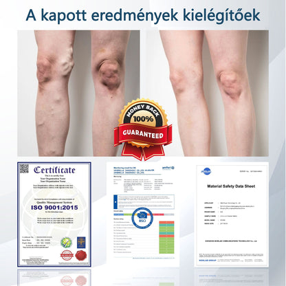 💧ATTDX® Növényi ödéma enyhítő krém nigellával💧💧💧💧