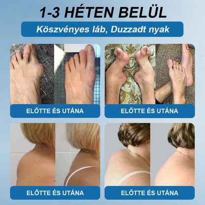 𝖯𝗂𝖼𝗱𝗼® BPC-157 Ízületi Gyógyító Krém🦴Ízületi gyulladás, neuropátia, reuma, sportsérülések és egyebek kezelésére🦵🦵🦵