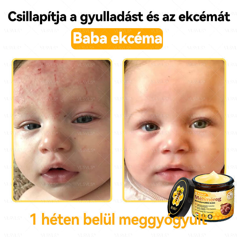 VLSVLS® Méhméreg Bőrhelyreállító Krém (👨‍⚕‍CE jóváhagyott)👍✅✅