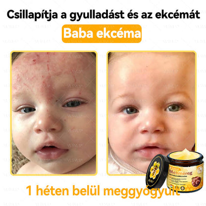 VLSVLS® Méhméreg Bőrhelyreállító Krém (👨‍⚕‍CE jóváhagyott)👍✅✅