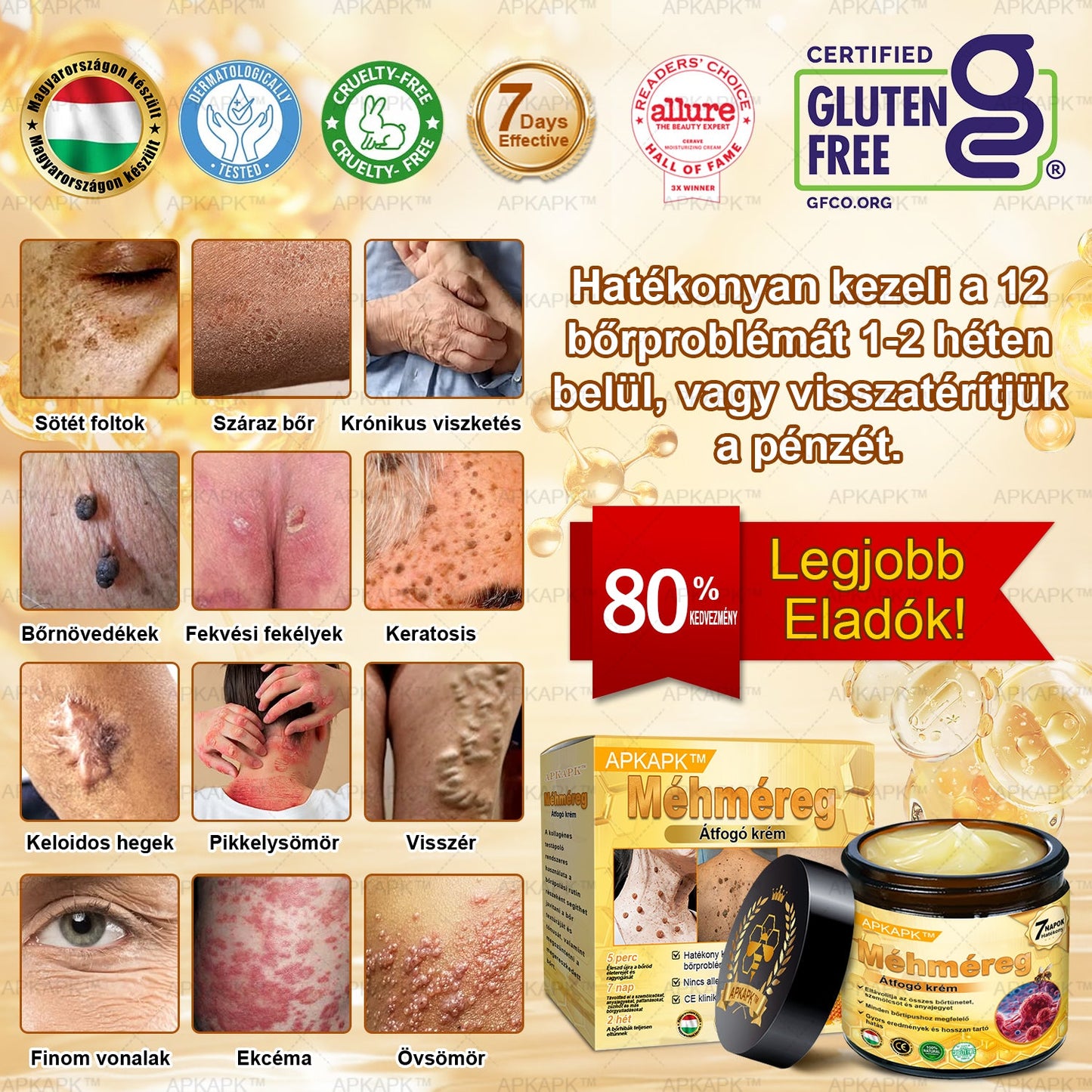 𝐀𝐏𝐊𝐀𝐏𝐊™ 𝐌É𝐇𝐌É𝐑𝐄𝐆 Á𝐓𝐅𝐎𝐆Ó 𝐊𝐑É𝐌🥇🥇𝐀 𝐛ö𝐫𝐩𝐫𝐨𝐛𝐥é𝐦á𝐤 𝐤𝐞𝐳𝐞𝐥é𝐬𝐞 𝐦𝐚𝐠á𝐛𝐚𝐧 𝐟𝐨𝐠𝐥𝐚𝐥𝐣𝐚: é𝐥𝐞𝐭𝐤𝐨𝐫𝐢 𝐟𝐨𝐥𝐭𝐨𝐤, 𝐡𝐞𝐠𝐞𝐤, 𝐬𝐳𝐞𝐦ö𝐥𝐜𝐬ö𝐤, 𝐛ö𝐫𝐧ö𝐯𝐞𝐝é𝐤𝐞𝐤, 𝐭á𝐥𝐲𝐨𝐠𝐨𝐤, 𝐩𝐚𝐭𝐭𝐚𝐧á𝐬𝐨𝐤, 𝐞𝐤𝐜é𝐦𝐚, 𝐩𝐬𝐨𝐫𝐢𝐚𝐬𝐢𝐬, 𝐚𝐜𝐧𝐞 𝐢𝐧𝐯𝐞𝐫𝐬𝐚, 𝐫á𝐧𝐜𝐨𝐤, 𝐛ö𝐫ö𝐫𝐞𝐠𝐞𝐝é𝐬 é𝐬 𝐞𝐠𝐲é𝐛 𝐩𝐫𝐨𝐛𝐥é𝐦á𝐤🔥🔥