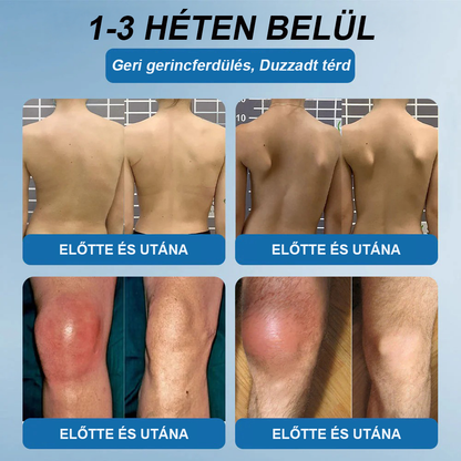 𝖯𝗂𝖼𝗱𝗼® BPC-157 Ízületi Gyógyító Krém🦴Ízületi gyulladás, neuropátia, reuma, sportsérülések és egyebek kezelésére🦵🦵🦵