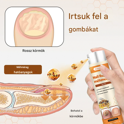 💥 2025 Korlátozott 70% KEDVEZMÉNY ️⏳ Ceoerty® NailRescue Kolirin méhméreg körömgomba spray 💥 Minden körömproblémát orvosolhatsz 2 héten belül👣