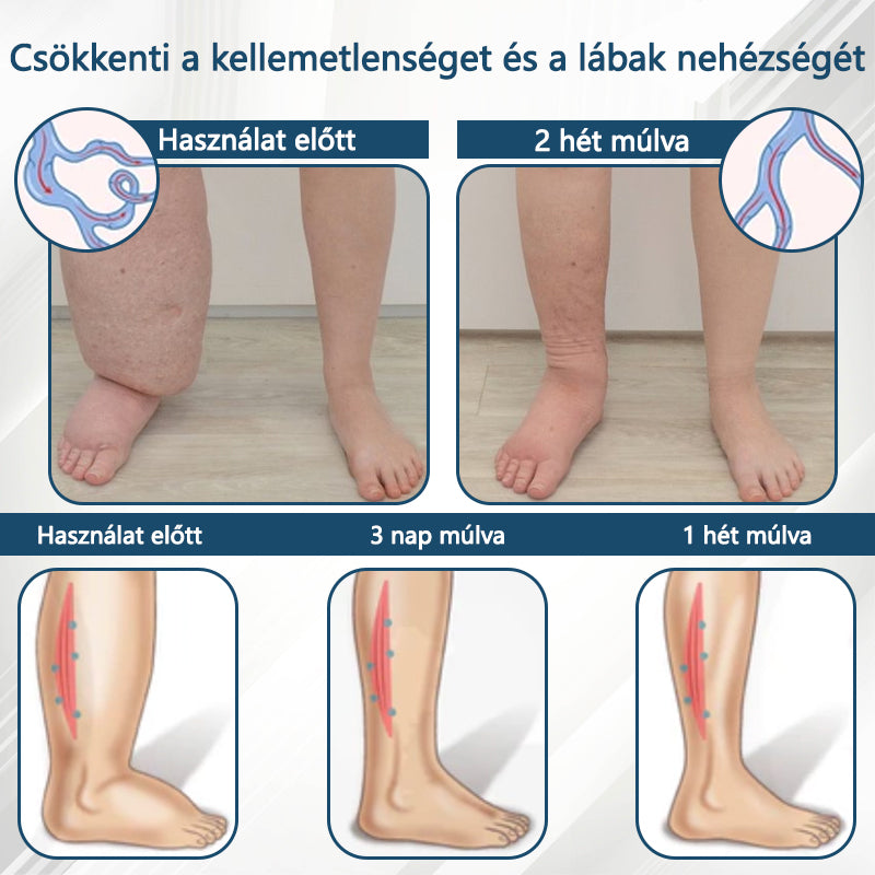 💧ATTDX® Növényi ödéma enyhítő krém nigellával💧💧💧💧