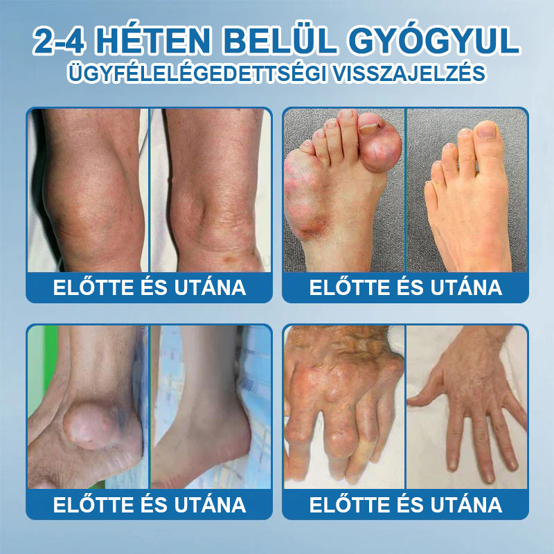 𝖯𝗂𝖼𝗱𝗼® BPC-157 Ízületi Gyógyító Krém🦴Ízületi gyulladás, neuropátia, reuma, sportsérülések és egyebek kezelésére🦵🦵🦵