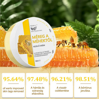 ✅flysmus™ méhméreg kezelő krém🐝: Ekcéma, pikkelysömör, akne, rosacea, gombás fertőzések, szemölcsök kezelése🐝🐝