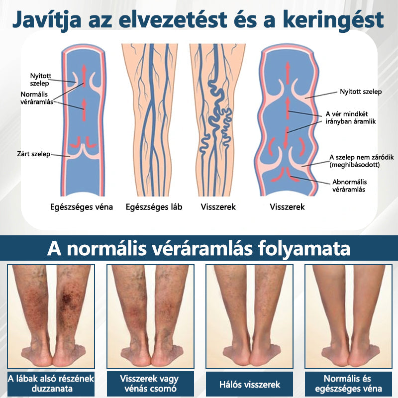 💧ATTDX® Növényi ödéma enyhítő krém nigellával💧💧💧💧