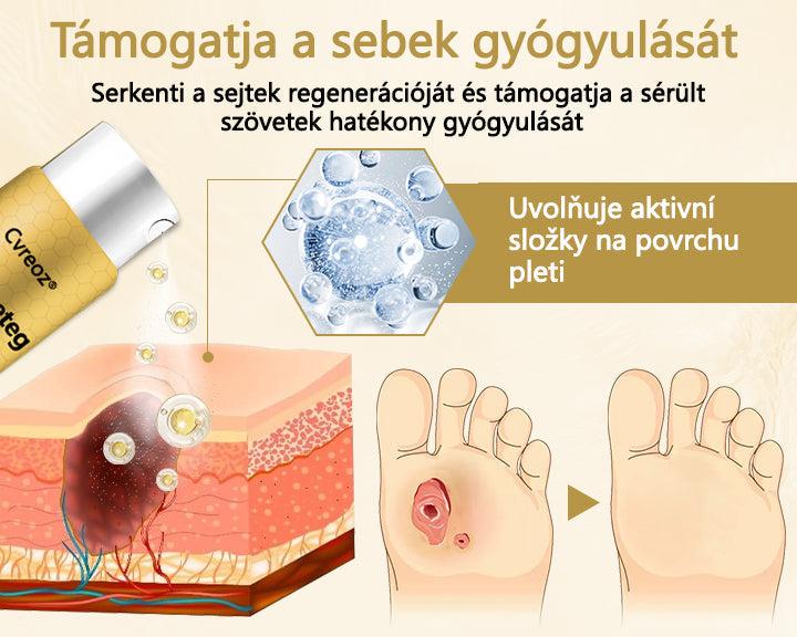 Cvreoz® méhméreg gyógyító spray a sebek gyógyulására és regenerálására a kezeken és a lábakon🌿🌿
