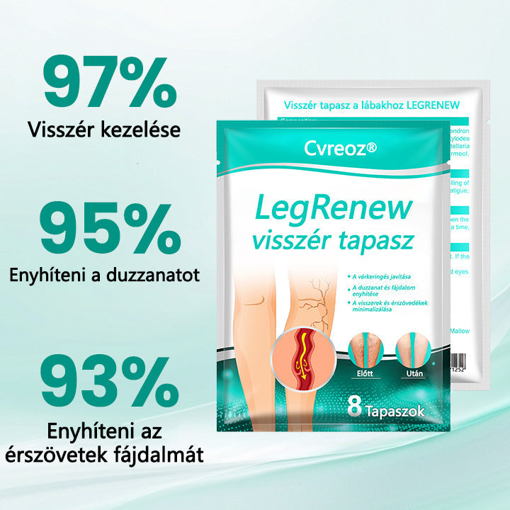 Cvreoz® LegRenew visszér tapasz javítja a vénák egészségét és megszünteti a visszereket🌿Nincs tű, nincs műtét, csak biztonságos, gyengéd és hatékony eredmény✨✨