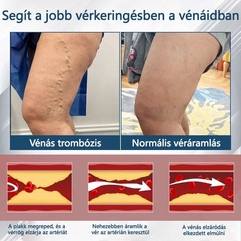 💧ATTDX® Növényi ödéma enyhítő krém nigellával💧💧💧💧