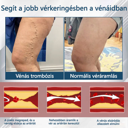 💧ATTDX® Növényi ödéma enyhítő krém nigellával💧💧💧💧