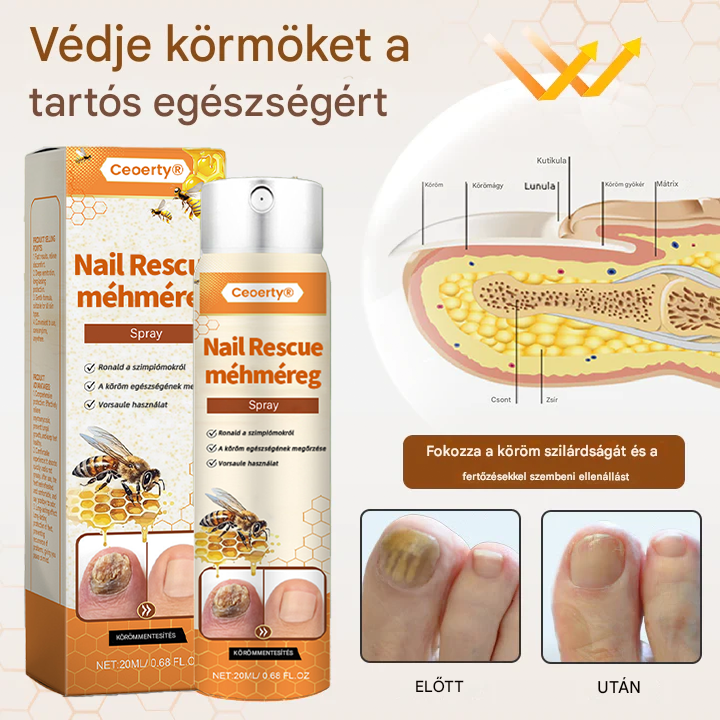 💥 2025 Korlátozott 70% KEDVEZMÉNY ️⏳ Ceoerty® NailRescue Kolirin méhméreg körömgomba spray 💥 Minden körömproblémát orvosolhatsz 2 héten belül👣