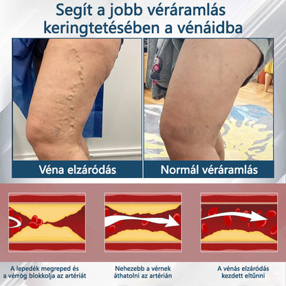 Cvreoz® Fekete kömény Ödéma méregtelenítő gyógynövénykrém - a gyors, látható enyhülés érdekében🍃🍃