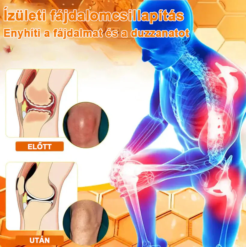 ✅ Hivatalos áruház: Ouryard™ Magnéziumolaj és Mézes Ízületjavító Spray 👨‍⚕️ Jóváhagyva a Magyar Gyógyszerészeti és Egészségügyi Minőség- és Szervezetfejlesztési Intézet (OGYÉI) által. 🔥🔥🔥🔥