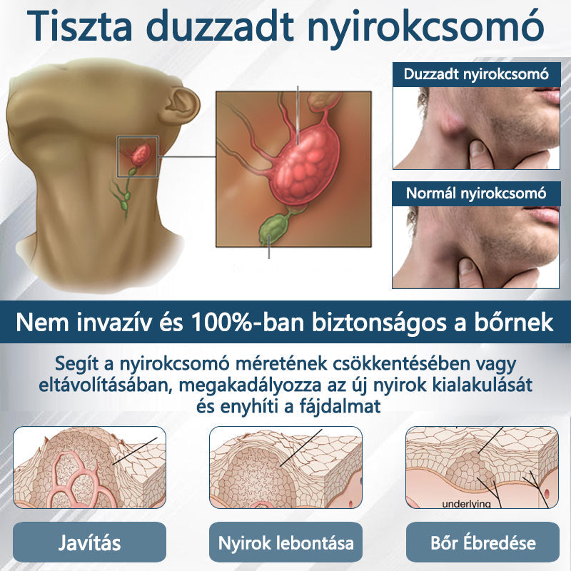 Cvreoz® Fekete kömény Ödéma méregtelenítő gyógynövénykrém - a gyors, látható enyhülés érdekében🍃🍃