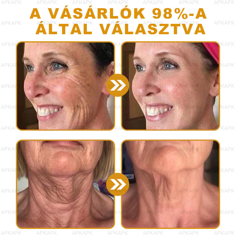 𝐀𝐏𝐊𝐀𝐏𝐊™ 𝐌É𝐇𝐌É𝐑𝐄𝐆 Á𝐓𝐅𝐎𝐆Ó 𝐊𝐑É𝐌🥇🥇𝐀 𝐛ö𝐫𝐩𝐫𝐨𝐛𝐥é𝐦á𝐤 𝐤𝐞𝐳𝐞𝐥é𝐬𝐞 𝐦𝐚𝐠á𝐛𝐚𝐧 𝐟𝐨𝐠𝐥𝐚𝐥𝐣𝐚: é𝐥𝐞𝐭𝐤𝐨𝐫𝐢 𝐟𝐨𝐥𝐭𝐨𝐤, 𝐡𝐞𝐠𝐞𝐤, 𝐬𝐳𝐞𝐦ö𝐥𝐜𝐬ö𝐤, 𝐛ö𝐫𝐧ö𝐯𝐞𝐝é𝐤𝐞𝐤, 𝐭á𝐥𝐲𝐨𝐠𝐨𝐤, 𝐩𝐚𝐭𝐭𝐚𝐧á𝐬𝐨𝐤, 𝐞𝐤𝐜é𝐦𝐚, 𝐩𝐬𝐨𝐫𝐢𝐚𝐬𝐢𝐬, 𝐚𝐜𝐧𝐞 𝐢𝐧𝐯𝐞𝐫𝐬𝐚, 𝐫á𝐧𝐜𝐨𝐤, 𝐛ö𝐫ö𝐫𝐞𝐠𝐞𝐝é𝐬 é𝐬 𝐞𝐠𝐲é𝐛 𝐩𝐫𝐨𝐛𝐥é𝐦á𝐤🔥🔥